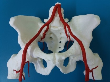 Лабораторія медичного 3D-друку Інституту травматології та ортопедій Національної академії медичних наук України - +38(066)160-24-74, +38(098)981-49-29. Термін виготовлення 3D моделі 2-4дні.