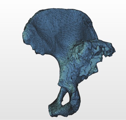 За допомогою сучасного 3D-принтера та спеціалізованого програмного забезпечення, у нашій лабораторії ми створюємо моделі анатомічних структур реального розміру та пропорцій за даними КТ та МРТ.