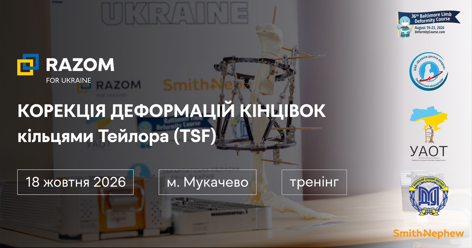 Корекція деформацій кінцівок за допомогою гексапода (TSF)