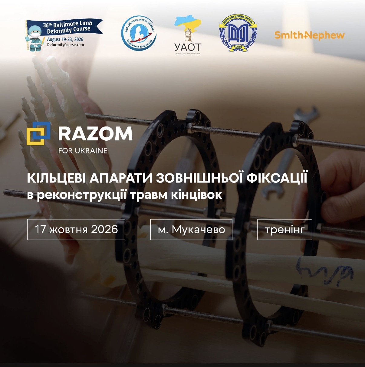  Кільцеві апарати зовнішньої фіксаціі в реконструкції травм кінцівок