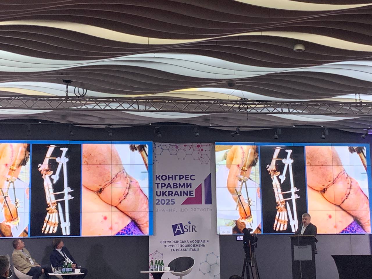 Конгресі Травми Ukraine 2025