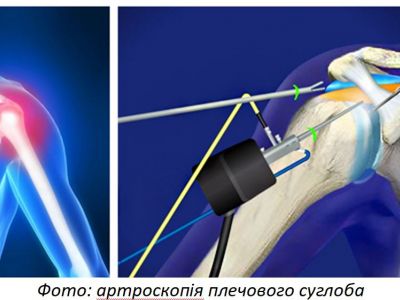 assets/uploads/2018/klinics/k-3/arthroscopy-k-3.JPG