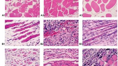 Administration of platelet-rich plasma or concentrated bone marrow aspirate after mechanically induced ischemia improves biochemical parameters in skeletal muscle