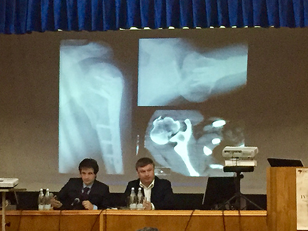 On October 20, 2017, on the basis of ITO of the National Academy of Sciences of Ukraine, with the participation of the Ukrainian Association of Orthopedic Traumatologists and with the participation of international specialists, 4 international training courses in shoulder surgery were held